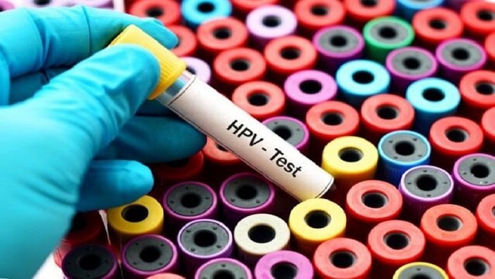 چه موقع باید تست hpv داد؟