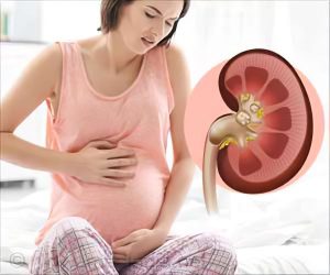 علائم و درمان سنگ کلیه در بارداری