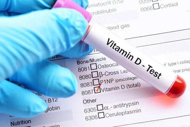 عوارض کمبود و مصرف بیش از حد ویتامین D