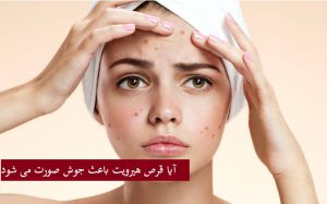 آیا قرص هیرویت باعث جوش صورت می شود؟