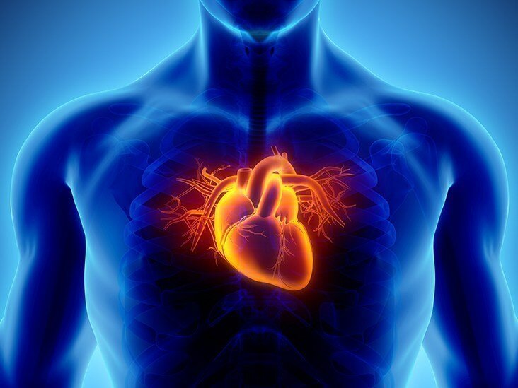 عوارض مکمل بدنسلزی سکته قلبی