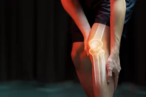 بهترین داروهای ضد التهاب مفاصل